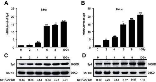 Figure 1 Irradiation increases the expression of Sp1 in cervical cancer cell lines. RT-qPCR assay showed Sp1 mRNA levels in SiHa (A) and HeLa (B) cells treated with doses of radiation. Western blot assay showed Sp1 protein levels in SiHa (C) and HeLa (D) cells treated with doses of radiation. Results shown are mean (±SD) values from three independent experiments. *P<0.05; **P<0.01; ***P<0.001.Abbreviation: RT-qPCR: real-time quantitative PCR.