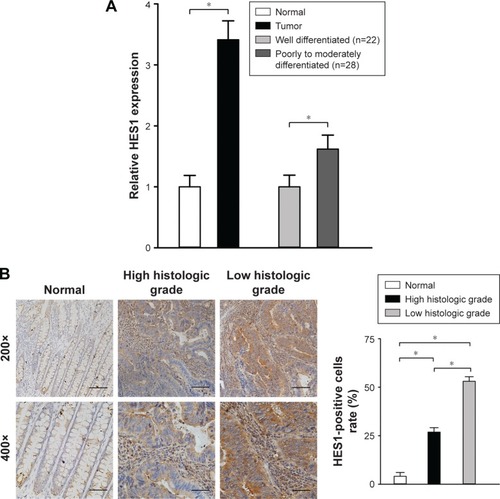 Figure 1 HES1 expression in CRC tissues and adjacent normal samples.