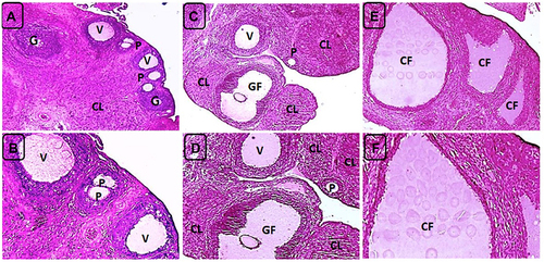 Figure 6 H&E-stained ovarian sections of negative control (NC) and PCOS rats on day 21. (A) NC rat showing a corpus luteum (CL) and ovarian follicles at different growth phases including primary (P), growing (G) and vesicular (V) follicles, X40. (B) higher magnification of A (X100). (C) NC rat showing multiple corpora lutea (CL) and ovarian follicles at different growth phases including primary (P), vesicular (V) and Graafian follicles (GF), X40. (D) higher magnification (X100) of C. (E) PCOS rats with absence of both ovarian follicles and corpora lutea and presence of multiple, variable-sized cystic follicles (CF), X40. (F) higher magnification of E (X100).