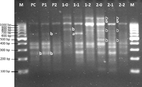 Figure 3. RAPD profiles of genomic DNA from root tips of F1 type U. pilulifera seedlings exposed to different Cd concentrations.