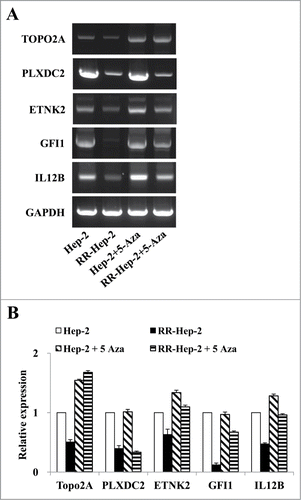 Figure 5. The mRNA expression levels of the 5 radioresistance-related genes in Hep-2 and RR-Hep-2 cells were positively associated with 5-Aza treatment. Hep-2 and RR-Hep-2 cells were treated with or without 5-Aza (5 μM) for 72 h, and (A) RT-PCR analysis was used to assess the mRNA expression levels of TOPO2A, PLXDC2, ETNK2, GFI1, and IL12B. (B) The mRNA levels of TOPO2A, PLXDC2, ETNK2, GFI1, and IL12B were measured by quantitative real-time PCR.