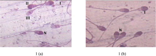 Figure 1. (a, b): Photograph showing normal (intact) and abnormal acrosome (Giemsa stain, Magnification 100x). N: intact acrosome; I: first degree of acrosomal damage showing different degree of ruffled acrosome, II: second degree of acrosomal damage (process of denudation), III: third degree of acrosomal damage (release of acrosomal cap).