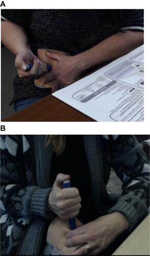 Figure 3 Simulated injections were performed using an artificial injection pad. (A) Simulation of an abdomen injection. (B) Simulation of a thigh injection.