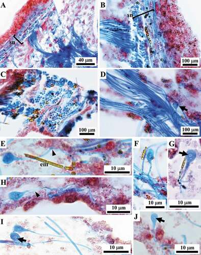 Figure 10. Sarcotragus spinosulus. LM photo-micrographs of skeletal histological sections. Associated endobiotic microorganisms (em) also evident. (A-B). Bundles of thick filaments with various orientations in the tangential subdermal network (sn; see Figure 11). (C). Bundles of thick filaments uniformly oriented (ectosome, cross-section). (D). Bundles of thick filaments and a single, thin knob-ended filament (arrow) (sagittal section). (E-J). Knob-ended thin filaments with wavy course (arrowheads) and drop-shaped knobs with evident lamellar structure surrounding a core (arrows). (Masson trichrome)