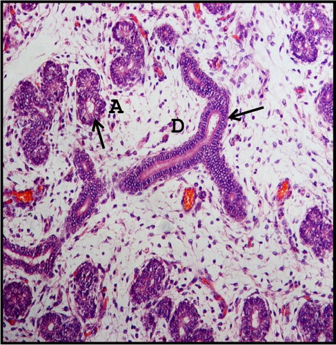 Figure 4. Photomicrograph of 18.6 cm CVRL (112th day) buffalo foetus showing single layer epithelial lining (arrows) of acinar cells (A) and ducts (D) of mandibular gland. Haematoxylin and Eosin method ×200.