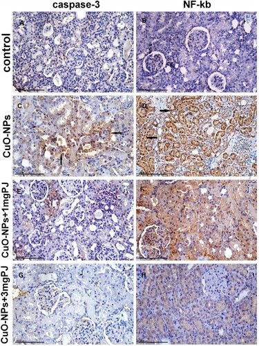 Figure 7 Immunohistochemical expression of caspase-3 and NF-ĸB protein in the kidney tissue sections in different groups showing (A and B) mild to negative caspase-3 and NF-ĸB protein expression in control negative group. (C and D) Moderate positive caspase-3 and extensive nuclear translocation of NF-ĸB protein within the renal tubular epithelial cells in the group intoxicated with CuO-NPs. (E and F) Mild to moderate positive caspase-3 and NF-ĸB protein expression in group pretreated with 1 mL/kg bwt PJ. (G and H) Mild to negative caspase-3 and NF-ĸB protein expression in group treated with 3 mL/kg bwt PJ.