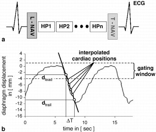 Figure 1. (a) Scheme of the multi‐heart phase, ECG triggered imaging sequence. Data from leading (L‐NAV) and trailing (T‐NAV) navigator were recorded for retrospective corrections. (b) Linear interpolation (black) performed between leading (dlead) and trailing (dtrail) navigator.