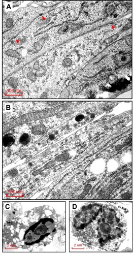 Figure 2 Morphologic changes of TM4 cells by Cur-PLGA-NPs treatment under transmission electron microscopy. (A) Control group treated by 50 μM PLGA-NPs, arrowhead indicating the anchoring junction structure. (B) Experimental group treated by 50 μM Cur-PLGA-NPs, no anchoring junctions were found. Bar = 500 nm. (C–D) TM4 cells in experimental group showing typical signs of apoptosis, including chromatin condensation, nuclei fragmentation and degenerated organelles. Bar = 2 μm.