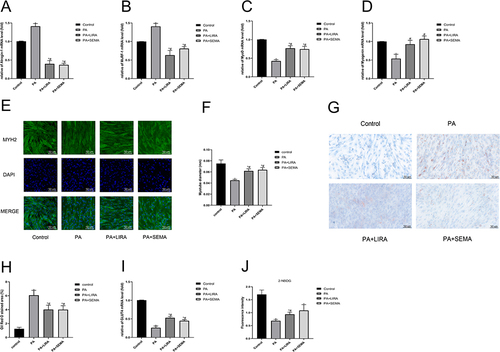Figure 4 Liraglutide and semaglutide alleviated PA induced muscle atrophy, lipid accumulation, and insulin resistance in C2C12 myotubes. (A) The mRNA level of Atrogin-1 was measured by qRT-PCR. (B) The mRNA level of MuRF-1 was measured by qRT-PCR. (C) The mRNA level of MyoD was measured by qRT-PCR. (D) The mRNA level of Myogenin was measured by qRT-PCR. (E) Representative images of MYH2 immunofluorescence in C2C12 myotubes (scale bar = 50 μm). (F) The diameter of myotubes. (G) Representative images of lipid accumulation in C2C12 myotubes stained with oil red O (scale bar = 50 μm). (H) The Oil red staining area. (I) The mRNA level of GLUT4 was measured by qRT-PCR. (J) The fluorescence intensity of 2-NBDG glucose uptake. *P < 0.05 compared with the control group, #P < 0.05 compared with the PA group.