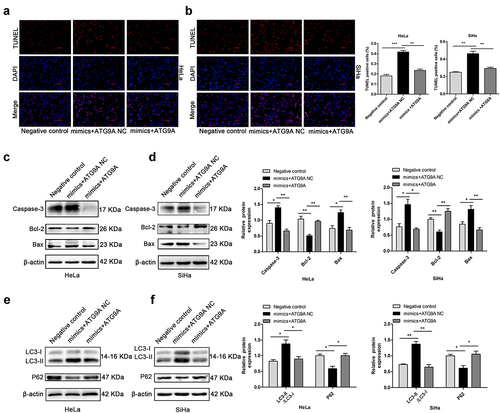 Figure 6. MiR-195-5p induces apoptosis and autophagy of CC cells by inhibiting ATG9A. (a,b) TUNEL assay (magnification, ×100) was performed after transfection with negative control, mimics + ATG9A NC, and mimics + ATG9A. (c,d) expression of Caspase-3, Bcl-2, and Bax measured by western blotting. (e,f) expression of LC3-II and P62 by western blotting. Experiments were repeated three times (n = 3). *p < 0.05 and **p < 0.01 versus control group.