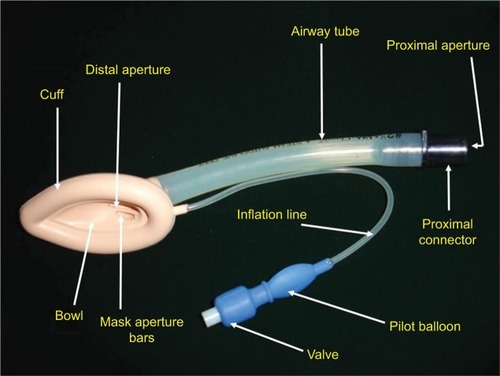 Figure 3 Classic LMA.