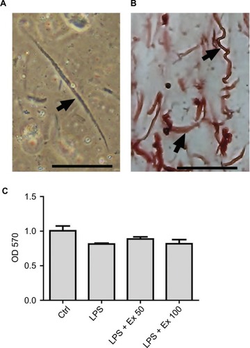 Figure 1 Identification of mouse CSMCs. (A) Single CSMC appeared in spindle shape (arrow) under phase contrast microscopy. Cells were viewed via inverted Nikon TMS-F microscope, and the image captured with a Canon digital camera. (B) Immunohistochemical staining of paraffin-embedded mouse CSMCs (arrows) using anti-h1-calponin antibody. (C) Cell viability assay for cells treated with vehicle (Ctrl), LPS, LPS+exendin-4 (50 nM), or LPS+exendin-4 (100 nM). Pictures were viewed at 20× magnification, scale bar=50 μm.Abbreviations: CSMC, colon smooth muscle cell; Ex 50, exendin-4 (50 nM); Ex 100, exendin-4 (100 nM); LPS, lipopolysaccharide; OD, optical density; Ctrl, control.