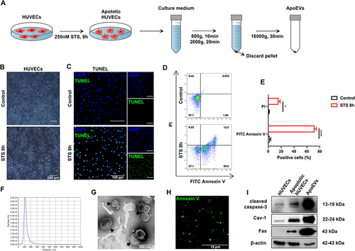 Figure 1 Isolation and characteristics of ApoEVs. (A) Schematic view of the process of isolating ApoEVs. Briefly, HUVECs were induced by 250 nM STS for 8 h and then the culture medium was sequentially centrifuged to obtain ApoEVs. (B) The morphology of normal and apoptotic HUVECs. Scale bar=200 μm. (C) TUNEL analysis of normal and apoptotic HUVECs. Apoptotic cells were indicated by TUNEL-positive cells (green). Scale bar=100 μm. (D) Flow cytometry analysis of normal and apoptotic HUVECs. (E) Statistic analysis of the percentage of positive cells. (F) NTA analysis of the size distribution of ApoEVs. (G) TEM analysis of the morphology and size of ApoEVs. Scale bar=200 nm. (H) Immunofluorescence staining of ApoEVs. ApoEVs were indicated by an apoptosis-specific surface marker, Ptdser (shown by Annexin V staining, green). (I) Western blotting analysis of cleaved caspase 3, Cav 1, Fas, and β-actin expressed in normal HUVECs, apoptotic HUVECs, and ApoEVs. The significance was tested with an unpaired two-tailed Student’s t-test. (*p<0.05, ****p<0.0001).