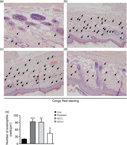 Fig. 4 Eosinophil infiltration in the dorsal skin of mice. CR-stained dorsal skin lesions were observed in the control (a), excipient (b), GI7-L (c), and GI7-H (d) groups. GI7-H is demonstrated to have an inhibitory effect on eosinophil infiltration (arrow) of AD-like skin lesions compared with that of the excipient and GI7-L groups (e). Results are expressed as the mean+SD (n=6). **p<0.01, ***p<0.001 versus the control group; # p<0.05 versus the excipient group; § p<0.05 versus the GI7-L group.