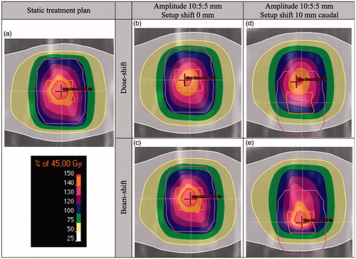 Figure 2. Static dose distribution and dose distributions considering breathing motion and setup shifts, calculated with the DSh and BSh methods, for patient 4, in frontal projection. The figure is provided in color in the digital version. The CTV (inner structure) and PTV (outer structure) are delineated.