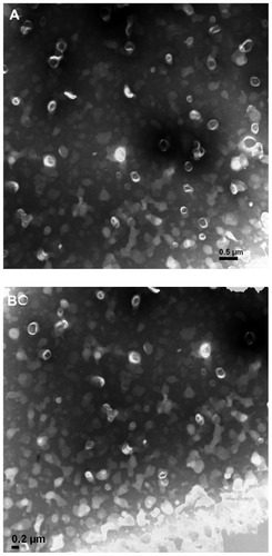 Figure 2 Transmission electron microscope pictures of emodin liposomes by negative staining with sodium phosphotungstate solution (×20,000). (A) TPGS liposomal emodin; (B) mPEG2000–DSPE liposomal emodin.Abbreviations: TPGS, D-α-tocopheryl polyethylene glycol 1000 succinate; mPEG2000–DSPE, methoxypolyethyleneglycol 2000-derivatized distearoyl-phosphatidylethanolamine.