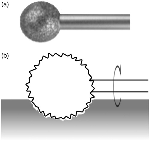 Figure 8. A diamond burr (a) and diagram showing how the burr abrades the bone by cutting microscopic grooves at it rotates (b).