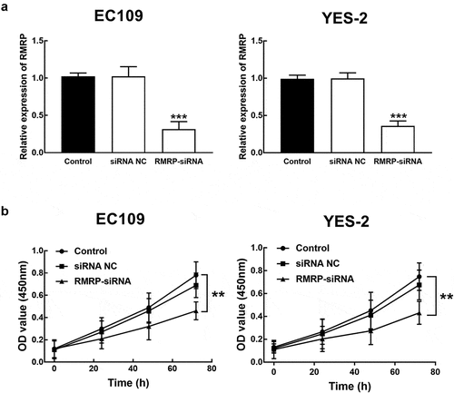 Figure 3. Effect of RMRP expression on cell proliferation of ESCC. A. The expression of RMRP in YES-2 and EC109 cells was significantly inhibited by the transfection of RMRP-siRNA. B. The knockdown of RMRP dramatically suppressed the proliferation of YES-2 and EC109 cells. **P < 0.01, ***P < 0.001