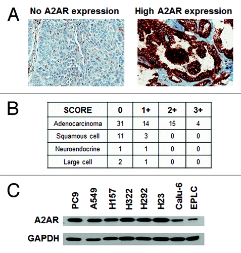 Figure 1. NSCLC cells express A2AR. (A) IHC analysis of A2AR expression in a lung cancer TMA. Representative pictures of 0 and 3+ A2AR expressing tumors are shown. (B) Table showing the expression of A2AR in lung tumors from the TMA. 0, no expression; +1 to +3, increasing expression of A2AR. (C) Immunoblot analysis of 8 NSCLC cell lines show expression of the A2AR.
