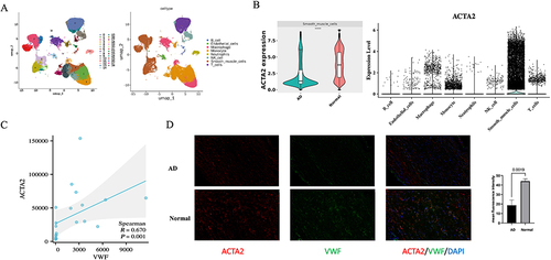 Figure 8 Analysis of the relationship between von Willebrand factor (VWF) and smooth muscle cells. (A) 29 cell clusters were identified from single-cell sequencing data of human aortic dissection (AD). Subsequently, 29 cell clusters were annotated into 8 cell types, including B cells, neutrophils, macrophages, NK cells, monocytes, endothelial cells, smooth muscle cells, and T cells. (B) Actin alpha 2, smooth muscle (ACTA2) was mainly expressed in smooth muscle cells, and its expression was significantly decreased in AD at single-cellular level. (C) The expression of VWF was significantly correlated with ACTA2 in human aortic tissues. (D) Representative images of immunofluorescent staining of VWF in aortic tissues from control and AD patients. Nuclei (blue) were visualized with DAPI. ACTA2 (red) – actin alpha 2, smooth muscle, and VWF (green) – von Willebrand factor were labelled with the respective antibodies. The images showed that VWF was co-localized with ACTA2, the marker of smooth muscle cells, in the aortic tissues. Again, the expressions of both VWF and ACTA2 were significantly reduced in aortic tissues from AD patients compared to controls. ****p <0.0001.