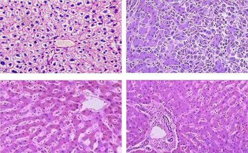 Figure 4. Liver cell regeneration pictures (Picture comes from Baidu Gallery)