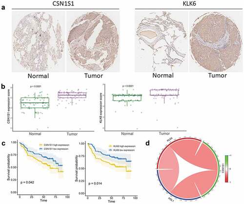 Figure 8. Validation of the gene signature in clinical tissue samples (a) Representative images of IHC staining for CSN1S1 and KLK6 expression in LUSC tissues and adjacent non-tumor tissues. (b) Protein expression scores in LUSC tissues and normal lung tissues. (c) Kaplan–Meier analysis of overall survival according to CSN1S1 and KLK6 expression levels. (d) Correlation of PD-L1 expression with KLK6 and CSN1S1 expression