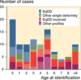Figure 2. Age at identification of the residual and relapsed clubfoot compared to the group of profiles of deformities in the clubfoot. Blue bars show the feet with solitary equinus and/or decreased dorsiflexion and green bars are those with other solitary deformities. Red bars indicate feet with combined profiles that contain EqDD and purple bars show feet with other combined profiles. Plain tones show patients that were referred to our clinic.