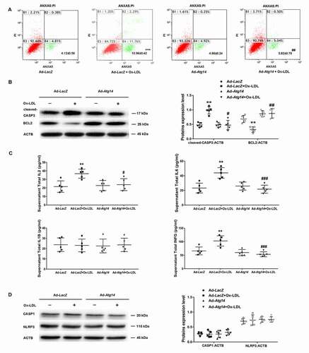 Figure 4. ATG14 overexpression inhibits apoptosis and inflammatory cytokines secretion in Ox-LDL-treated macrophage. (A) RAW264.7 cells were infected with adenoviruses harboring ATG14 (Ad-Atg14) or adenovirus vector (Ad-LacZ) for 48 h, and followed with Ox-LDL (10 ng/ml) for 24 h, Flow cytometry examined ANXA5 in experimental cells. (B) Western blots and quantification analysis showed the expressions of cleaved-CASP3 and BCL2. (C) Culture supernatant were assayed for IL1B, IL2, IL6 and INFG by ELISA (n = 5 independent wells for each treatment). (D) Western blots and quantification analysis showed the expressions of CASP1 and NLRP3.Values are expressed as the mean±SD, n = 5; **p < 0.01, ***p ≤ 0.001 vs. the Ad-LacZ groups; #<0.05, ##p < 0.01, ###p ≤ 0.001 vs. the Ad-LacZ+Ox-LDL groups