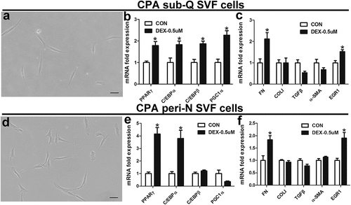 Figure 6. Effect of dexamethasone on SVF cells.