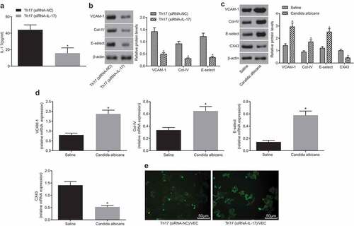 Figure 3. IL-17 gene silencing in Th17 cells inhibits activation of vascular endothelial cells. (a), The histogram of IL-17 level in Th17 (siRNA-NC) and Th17 (siRNA-IL-17) groups; (b), Relative mRNA levels of VCAM-1, E-selectin and Col-IV in Th17 (siRNA-NC) and Th17 (siRNA-IL-17) groups; (c), Relative mRNA levels of VCAM-1, E-selectin, Col-IV and CX43 in the Candida albicans and saline groups; (d), The histogram of mRNA levels of CX43 in different conditions; (e), The images of CX43 expression detected by immunofluorescence (× 200); IL, interleukin; Col-IV, Collagen 4; VCAM-1, vascular cell adhesion molecule 1; CX43, connexin43; *, p < 0.05; n = 12 in the saline group and n = 10 in the Candida albicans group; all data were measurement data, expressed as mean ± standard deviation and analyzed by t-test; the experiment was repeated for three times.