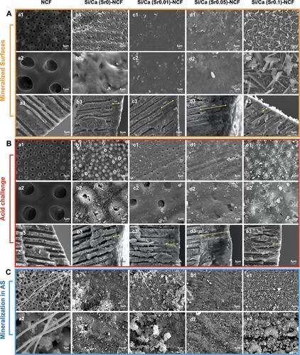 Figure 4 The SEM images of the remineralized dentine surfaces and longitudinal sections after applying the Si/Ca(Sr)-NCF mats. (A) SEM images presenting surface occluding and longitudinal infiltration of dentine discs (a1–a3) in distilled water, (b1–b3) in Si/Ca(Sr 0)-NCF group, (c1–c3) in Si/Ca(Sr 0.01)-NCF group, (d1–d3) in Si/Ca(Sr 0.05)-NCF group and (e1–e3) in Si/Ca(Sr 0.1)-NCF group. (B) The SEM images presenting surface occluding and longitudinal infiltration after 6 wt% citric acid leaching. Images of dentine discs (a1–a3) in distilled water, (b1–b3) in Si/Ca(Sr 0)-NCF group, (c1–c3) in Si/Ca(Sr 0.01)-NCF group, (d1–d3) in Si/Ca(Sr 0.05)-NCF group, and (e1–e3) in Si/Ca(Sr 0.1)-NCF group. (C) The SEM images after immersing in artificial saliva for 7 days. Images presenting surface occluding (a1–a2) in distilled water, (b1–b2) in Si/Ca(Sr 0)-NCF group, (c1–c2) in Si/Ca(Sr 0.01)-NCF group, (d1–d2) in Si/Ca(Sr 0.05)-NCF group, and (e1 and e2) in Si/Ca(Sr 0.1)-NCF group.