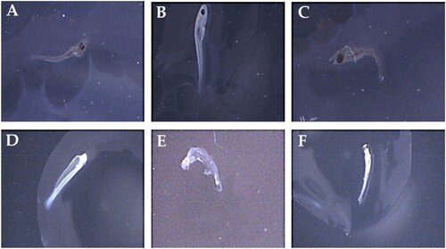 Figure 3. Morphological abnormalities in post-hatching stages of H. molitrix and C. idella. (A: lateral spine curvature-scoliosis; B: axial spine curvature-lordosis; C: cardiac edema; D: yolk-sac malformation; E: C-shaped body; F: spine curvature – lordosis).