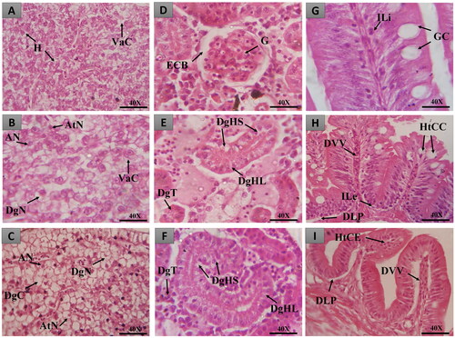 Figure 10. Histopathological changes observed in zebrafish liver, intestine and kidneys in different treatments. In A, B and C, liver tissue with normal hepatocytes (H), cytoplasmic vacuolization (VaC), nuclear atypia (an), nuclear atrophy (AtN), nuclear degeneration (DgN) and cell degeneration (DgC); in D, E and F, renal tissue with normal glomerulus (G), Bowman’s capsule space (ECB), tubular degeneration (DgT), mild tubular hyaline degeneration (DgHL) and severe hyaline degeneration (DgHS); in G, H and I, intestinal tissue with normal goblet cells (GC), lymphocyte infiltration (ILi), goblet cell hypertrophy (HtCC), dilation of vessels present in the villi (DVV), stromal leukocyte infiltration (ILe) as well as displacement of the lamina propria (DLP). Coloring (H&E).