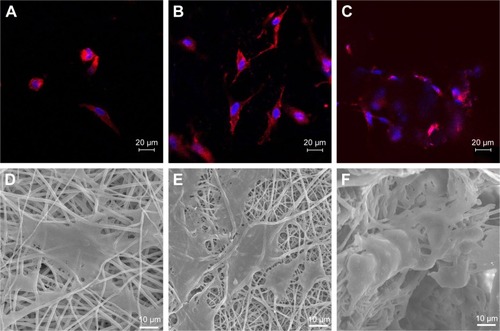 Figure 5 Morphology of rADSCs on scaffolds.Notes: Representative CLSM images of rADSCs on scaffolds after 1 day: PP (A), PP–B (B), 3D (C), cytoskeleton (red), and cell nuclei (blue). Representative SEM images of ADSCs on scaffolds after 7 days: PP (D), PP–B (E), and 3D (F).Abbreviations: 3D, three dimension; CLSM, confocal laser scanning microscopy; PP, poly(lactide-co-glycolide)/polycaprolactone; PP–B, PP–bone morphogenetic protein-2; rADSCs, rat adipose-derived stem cells; SEM, scanning electron microscopy.
