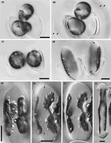 Figs 45–52. Sexual reproduction in Petroneis humerosa from Portobello beach, Edinburgh, LM, DIC optics. Fig. 45. Recently formed auxospores and gametangial thecae within a thick mucilage sheath. The junctions between the fused gametes are still visible (arrow) within each auxospore. Fig. 46. Same cells as in Fig. 45, but two days later. Integration of the gametes is complete and the auxospores are retracting towards each of the gametangial frustules. Note the double boundary of the mucilage sheath (arrows). Fig. 47. Spherical, binucleate auxospores after plasmogamy and retraction to within the gametangial thecae. Fig. 48. Same cells as in Fig. 47. Each auxospore has expanded along the longitudinal axis of the parent theca and developed a silicified perizonium around the cell. The protoplast has pulled inwards, away from the perizonium (arrows). Fig. 49. Expanded auxospore showing a lightly silicified transverse perizonium in section at left, and the central longitudinal band (striations right of centre). Fig. 50. Near-surface focus of expanded auxospore, showing transverse perizonium. Note the straight, central band (white arrows) and the other curved bands, which appear to be interrupted at the longitudinal suture (between black arrows). Fig. 51. Different focus of the cell shown in Fig. 50. Two H-shaped chloroplasts lie around the periphery on opposite sides of the auxospore. The nuclei (still unfused) lie beneath the intersection of the longitudinal suture and the central transverse band of the perizonium. Fig. 52. Expanded auxospore of Navicula oblonga. Note the caps of organic material at each pole, and the linear-concave outline of the auxospore. Scale bars represent 20 µm.