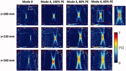 Figure 5. Temperature distributions with MR thermometry for phantom experiments using the vortex beam modes 0 and 4 with 100%, 80%, and 60% partial elements (PE). Sonications were applied at the focal depth of 100 mm (top row), 130 mm (center row), and 160 mm (bottom row). Red dashed line indicates the position of phantom. A black solid line indicates an area of temperature rise above 4°C (top right).