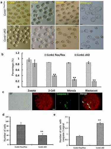 Figure 6. GC-specific Cyclin B1 deletion gave rise to abnormal embryonic development and poor blastocyst quality. (a) Representative images of zygotes, 2-cell embryos, morulas and blastocysts are shown in the Ccnb1Flox/Flox and Ccnb1 cKO groups. Scale bar, 50 μm. (b) The percentages of zygotes, 2-cell embryos, morulas, and blastocysts are shown. (c) The blastocysts were stained with cleaved caspase 3 (white arrow, green) and DAPI (red). BF, brightfield. Scale bar, 10 μm. (d) The average cell number of one blastocyst. (e) The number of cells containing cleaved caspase 3 signals in one blastocyst. The data are the means ± SEM. In (B), (D) and (E), ** P < 0.01, > 30 oocytes were examined in each experiment. Each experiment was repeated more than 3 times.