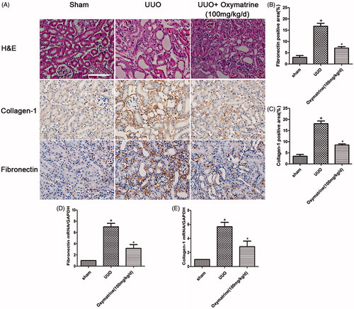 Figure 1. OMT ameliorates renal injury and interstitial matrix disposition in UUO at 7 days after surgery. (A) Representative micrographs of HE staining, immunohistochemical staining for COI-1 and FN expression, and original magnification ×200. (B, C) Quantitative analysis of FN and COI-1 for immunohistochemistry staining. (D, E) mRNA levels of COL-1 and FN in the different treated groups. +p < 0.01 versus sham group, *p < 0.01 versus UUO with vehicle-treated group. (Scale bars: 200 μm).