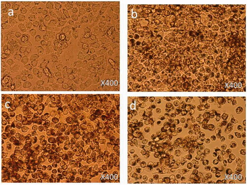 Figure 4. Cell morphology: the HCT-116 cells were non-treated (a) and treated with FMSP-nanoparticles (50 μg/mL) for 6 h (b), 24 h (c) and 48 h (d). 400× magnification.