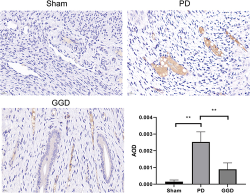 Figure 3 Inhibitory effect of GGD on HSP90 expression. The protein levels of HSP90 in the uterine tissue of rats in each group were detected by IHC and quantified (Magnification × 400). Data are presented as the means ± SD. **P<0.01, n=6.