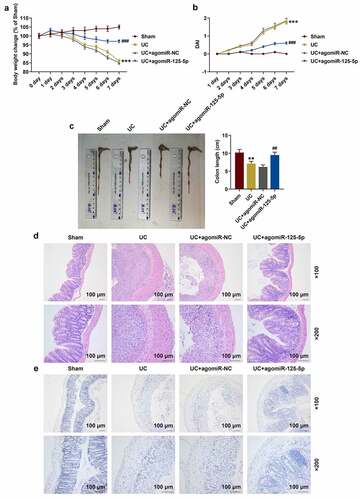 Figure 6. Effects of miR-125-5p agomiR on body weight, DAI, colon length, histopathological changes, and apoptosis in ulcerative colitis (UC) mouse models. (a) Changes in body weight of mice in the Sham, UC, UC + agomiR-NC, and UC + agomiR-125-5 groups were recorded. (b) The disease activity index (DAI) of each group of mice was scored according to the average value of the three parameters of stool consistency, stool blood and percent weight loss. (c) Colonic length of the mice in each group was measured. (d) Histopathological changes in the colon of mice in each group were evaluated using hematoxylin-eosin (H&E) staining. Scale = 100 μm. (e) Apoptosis levels in colon tissues of mice in each group were measured by TUNEL method. Scale = 100 μm. All the experiments have been performed triplicate. ** P < 0.01, *** P < 0.001 vs. Sham; ## P < 0.01, ### P < 0.001 vs. UC + agomiR-NC