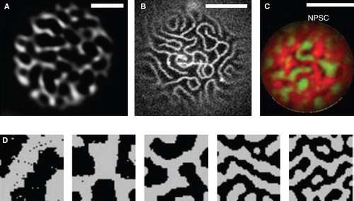 Figure 1. Network-like domains of proteins and lipids. (A) Pattern of the ATPase Pma1 in the budding yeast PM imaged by TIRFM. (B) Domains of FITC-LB21 peptide in a GUV made of PC and cholesterol. Reproduced from Kaiser et al. (Citation2011). (C) Network pattern in a GUV made from native pulmonary surfactant (NPS), with DiIC18 (red) and Bodipy-PC (green). Reproduced from Bernardino De La Serna et al. (Citation2009). (D) Patterns formed in simulations of lipid segregation by hydrophobic mismatch. Reproduced from Wallace et al. (Citation2006). Scale bars: 2 μm (A) and 10 μm (B, C). This Figure is reproduced in color in the online version of Molecular Membrane Biology.