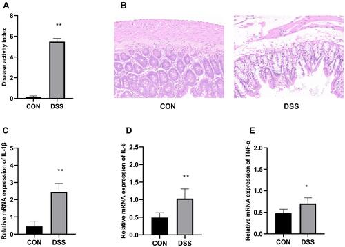 Figure 1 Assessment of disease activity index (A). Histopathological analysis of the colon of the control and DSS groups colitis (B), colon tissues were stained with H&E (200×magnification). mRNA expression of the proinflammatory cytokines IL-1β (C), IL-6 (D), TNF-α (E). Data are means±SD (n=7), *p<0.05, **p<0.01 compared to the control group.