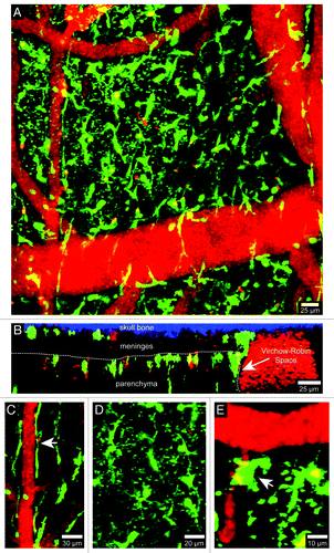 Figure 1. Visualization of brain myeloid cells in CX3CR1-GFP mice. TPLSM was used to capture 4D time-lapses through a thinned skull window of a naïve CX3CR1-GFP+/− mouse. The bone was thinned down manually to a thickness of ~30 µm and then imaged using a Leica SP5 two-photon microscope fitted with a 20x water dipping objective (1.0 NA). For imaging, the lens was dipped into artificial cerebral spinal fluid placed on top of the thinned skull window. Images were collected with a 1.0 µm step size to a depth of 100 µm beneath the skull surface. Z stacks were acquired every minute. Panel A shows the xy distribution of innate myeloid cells (green) in the meninges and neocortex of a naïve mouse brain. Blood vessels (red) were labeled by injecting 655-nm quantum dots intravenously before imaging. Panel B shows an xz projection from the same image stack in which the skull bone (blue), meninges, and brain parenchyma are visible. The white dotted line denotes the glial limitans. The Virchow-Robin space adjacent to a large blood vessel is also visible (white arrow). Note that the density of innate myeloid cells is greater in the parenchyma than in the meninges. CX3CR1-GFP+/− mice can be used to visualize meningeal macrophages (C, white arrow), microglia (D), and perivascular macrophages (E, white arrow). Meningeal macrophages (C) are worm-like cells that line blood vessels in the meninges. Perivascular macrophages (E) reside in Virchow-Robin spaces and adjacent to blood vessels found the brain parenchyma (white arrow). Microglia (D) are the most common CNS myeloid cell and are distributed uniformly throughout the brain parenchyma. Note that microglia are highly ramified cells, whereas meningeal and perivascular macrophages are not. See Video S1.