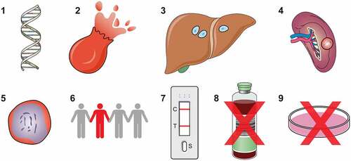 Figure 3. Challenges in Plasmodium vivax. Vivax malaria presents a unique set of challenges for elimination. 1. Genetic mutations: CYP2D6 polymorphisms decrease effectiveness of radical cure, G6PD deficiency predisposes to 2. Drug-induced haemolysis. 3. Hypnozoite reactivation in the liver causes most new episodes of P. vivax malaria. 4. Reservoirs of hidden infection include the spleen (illustrated) and bone marrow. 5. P. vivax forms gametocytes early in infection, increasing transmissibility. 6. Asymptomatic carriers of vivax whose infection may be submicroscopic (figure in red) are common. 7. Low-density infections may not be detected by RDTs. 8. There are no imminent prospects for a P. vivax vaccine. 9. Robust in vitro culture systems are yet to be developed.