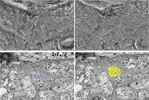 Figure 4. Image loading steps using the Amira program. (a) Set of images loaded in Amira. When the axes are aligned, serial images can be viewed through the Orthoslices tool. (b) Image labeled using the Segmentation editor. Yellow colored area indicates a labeled cyst. Spermatocytes were labeled separately so as not to interrupt the channels. (c–d) Images before applying the Alignslices tool (c). Arrowhead indicates unaligned portion of the image. Aligned images after applying the Alignslices tool (d).