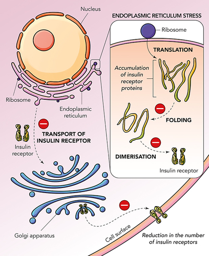 Figure 1 Mechanisms leading to insulin resistance in diabetes mellitus.