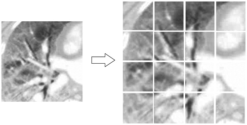Figure 4. Segmentation of LL(0)image.