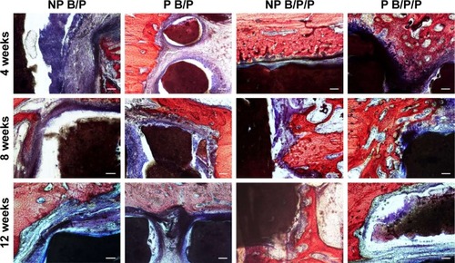 Figure 9 Histological staining of new bone formation after implantation of scaffolds seeded with BMSCs into critical size bone defects in the rabbit radius.Notes: The newly formed bone is stained red, fibrous tissue is blue and the scaffolds are black (Van Gieson’s staining); scale bars: 100 μm.Abbreviations: BMSCs, bone marrow-derived mesenchymal stem cells; NP B/P, nonprinted biphasic calcium phosphate/polyvinyl alcohol; NP B/P/P, nonprinted biphasic calcium phosphate/polyvinyl alcohol/platelet-rich fibrin; P B/P, printed biphasic calcium phosphate/polyvinyl alcohol; P B/P/P, printed biphasic calcium phosphate/polyvinyl alcohol/platelet-rich fibrin.