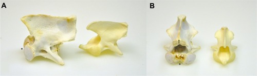 Figure 3 Photographs of the misshapen axis (left) and of a control axis (right), cranial aspect. The lack of a dens (*) and bilaterally misshapen and flattened cranial articular processes are featured (A and B). The spinous process has a 12 mm long spade-shaped callus (†) on the cranial aspect (B).